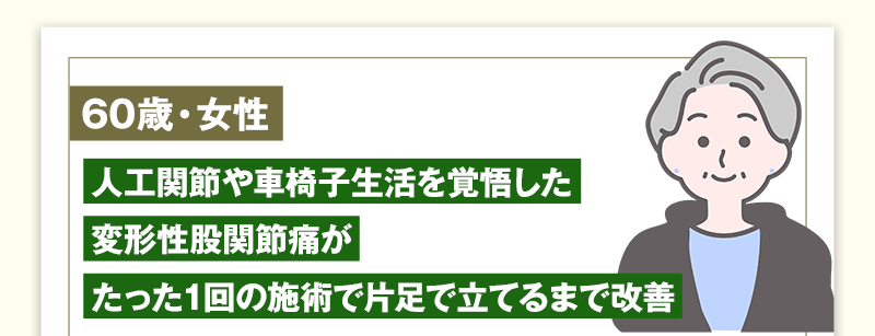 60歳女性　人工関節や車椅子生活を覚悟した変形性股関節痛がたった1回の施術で片足で立てるまで改善